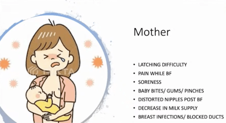 Tongue-ties and Lip-ties- What Parents Should&nbsp;know