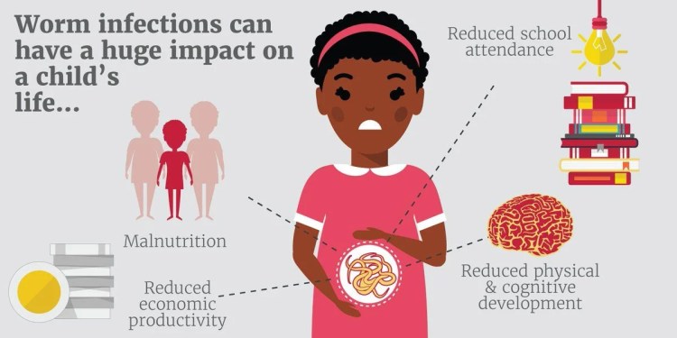 Deworming in Children